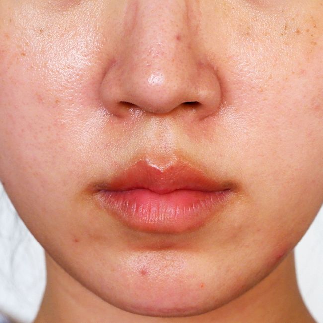 What Your Skin Barrier Actually Is and How to Protect It