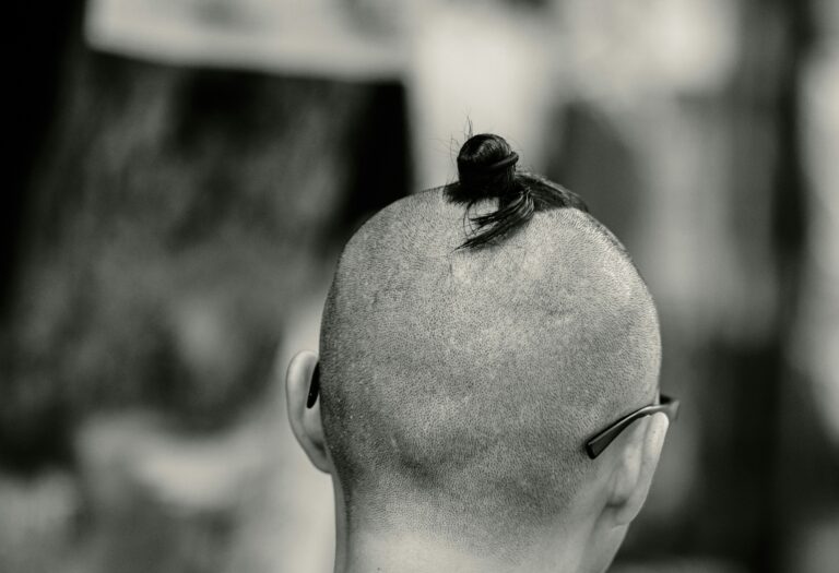 Hair Shedding vs Hair Loss: How To Tell The Difference